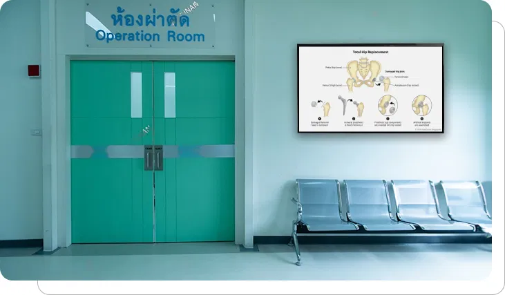Surgery digital signage showing surgical visualizations